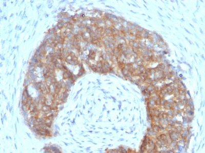 Monoclonal Antibody to pS2 / pNR-2 / Trefoil Factor 1 (Estrogen-Regulated Protein)(Clone : SPM313)