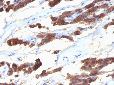 Monoclonal Antibody to Thyroglobulin (Thyroidal Cell Marker)(Clone : SPM221)