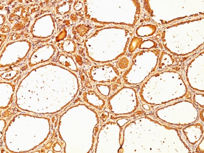 Monoclonal Antibody to Thyroglobulin (Thyroidal Cell Marker)(Clone : SPM517)