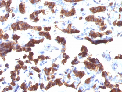 Monoclonal Antibody to Thyroglobulin (Thyroidal Cell Marker)(Clone : TGB24)