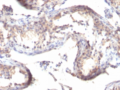 Monoclonal Antibody to TGF-alpha (Transforming Growth Factor alpha)(Clone : MF9)