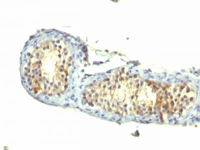 Monoclonal Antibody to TGF-alpha (Transforming Growth Factor alpha)(Clone : 1E8-G6)