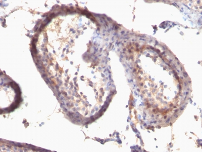 Monoclonal Antibody to TGF-alpha (Transforming Growth Factor alpha)(Clone : SPM542)