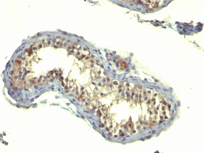 Monoclonal Antibody to TGF-alpha (Transforming Growth Factor alpha)(Clone : TG86)