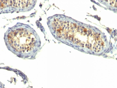 Monoclonal Antibody to TGF-alpha (Transforming Growth Factor alpha)(Clone : P/T1)