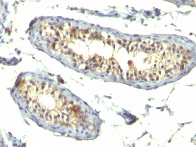 Monoclonal Antibody to TGF-alpha (Transforming Growth Factor alpha)(TG86 + P/T1)