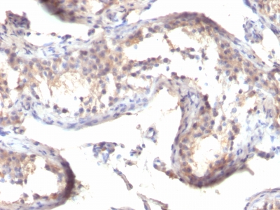 Monoclonal Antibody to TGF-alpha (Transforming Growth Factor alpha)(Clone : TGFA/1119)