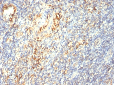 Monoclonal Antibody to Transglutaminase II (TGM2)(Clone : TGM2/419)