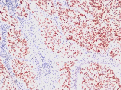 Monoclonal Antibody to TTF-1 / NKX2.1 (Thyroid & Lung Epithelial Marker)(Clone : SPM150)