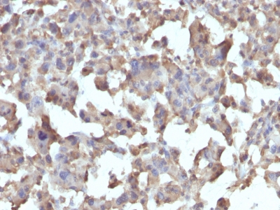 Monoclonal Antibody to TNF-alpha (Tumor Necrosis Factor alpha)(Clone : TNFA/1172)