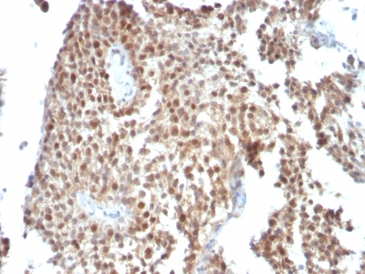 Monoclonal Antibody to p53 Tumor Suppressor Protein(Clone : SPM590)