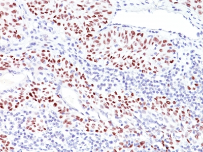 Monoclonal Antibody to p53 Tumor Suppressor Protein(Clone : TRP/816)