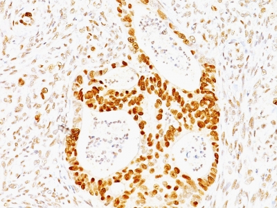 Monoclonal Antibody to p53 Tumor Suppressor Protein(Clone : TRP/817)