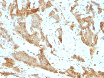 Monoclonal Antibody to GRP94 / HSP90B1 (Endoplasmic Reticulum Marker)(Clone : SPM249)