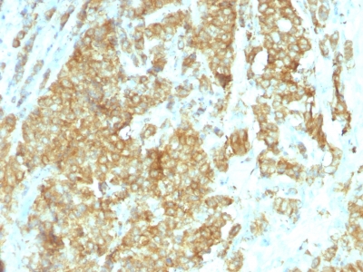 Monoclonal Antibody to GRP94 / HSP90B1 (Endoplasmic Reticulum Marker)(Clone : HSP90B1/1192)