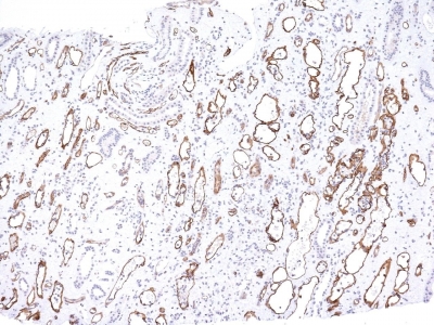 Monoclonal Antibody to Complement 4d (C4d) (Acute Humoral Rejection Marker)(Clone : C4D204)