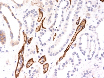 Monoclonal Antibody to Complement 4d (C4d) (Acute Humoral Rejection Marker)(Clone : SPM545)