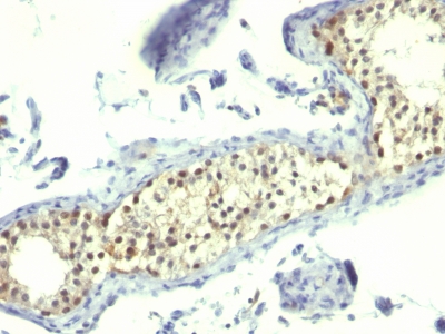 Monoclonal Antibody to Thymidylate Synthase (5-FU Resistance Marker)(Clone : TS106)