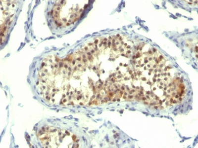 Monoclonal Antibody to Thymidylate Synthase (5-FU Resistance Marker)(Clone : TMS715)