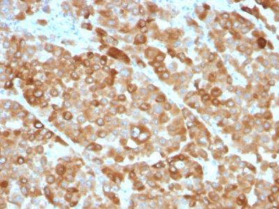 Monoclonal Antibody to Tyrosinase (Melanoma Marker)(Clone : OCA1/812)