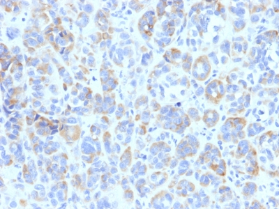 Monoclonal Antibody to Tyrosinase-Related Protein-1 (TYRP-1) (Melanoma Marker)(Clone : TYRP1/807)