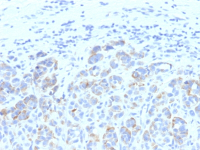 Monoclonal Antibody to Tyrosinase-Related Protein-1 (TYRP-1) (Melanoma Marker)(Clone : SPM611)