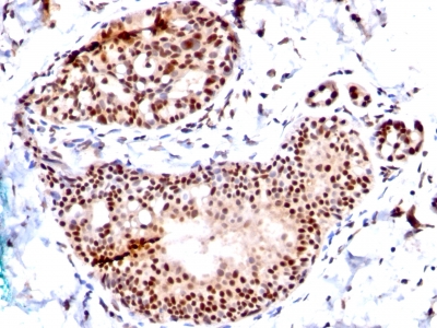 Monoclonal Antibody to SUMO-1(Clone : SM1/495)