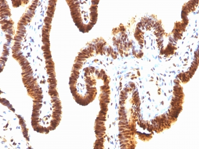 Monoclonal Antibody to SUMO-1(Clone : SPM571)