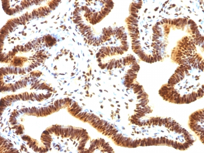 Monoclonal Antibody to SUMO-1(Clone : SUMO1/1188)