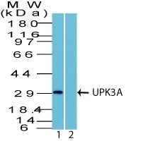 Polyclonal Antibody to Uroplakin 3A (Bladder Carcinoma Marker)