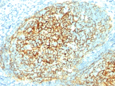 Monoclonal Antibody to CD106 / VCAM1 (Activated Endothelial Cell Marker)(Clone : 1.4C3)