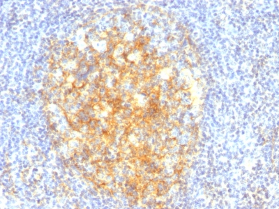 Monoclonal Antibody to CD106 / VCAM1 (Activated Endothelial Cell Marker)(Clone : VCAM1/843)