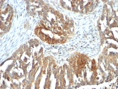 Monoclonal Antibody to VEGF (Vascular Endothelial Growth Factor)(Clone : VEGF/1063)