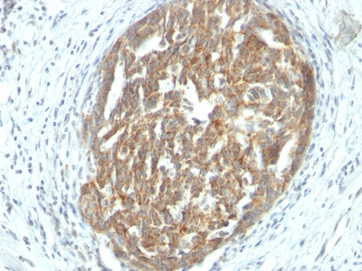 Monoclonal Antibody to VEGF (Vascular Endothelial Growth Factor)(Clone : SPM225)