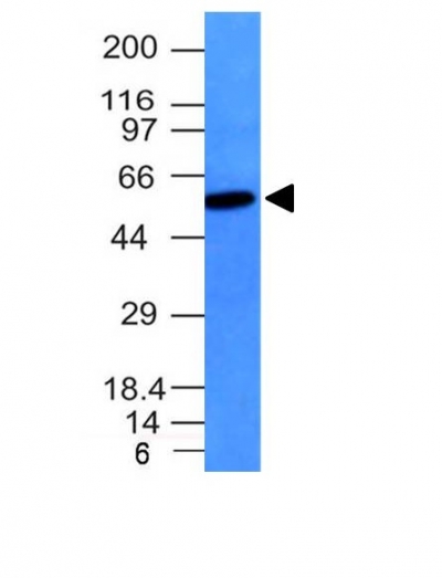 Monoclonal Antibody to Vimentin (Mesenchymal Cell Marker)(Clone : VM452)