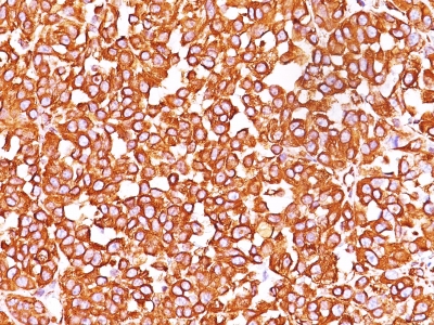 Monoclonal Antibody to Vimentin (Mesenchymal Cell Marker)(Clone : SPM576)