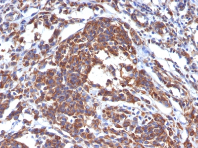 Monoclonal Antibody to Vimentin (Mesenchymal Cell Marker)(Clone : LN-6)