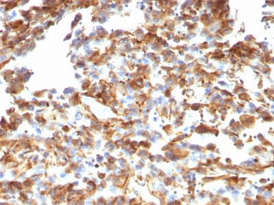 Monoclonal Antibody to Vimentin (Mesenchymal Cell Marker)(Clone : VM1170)