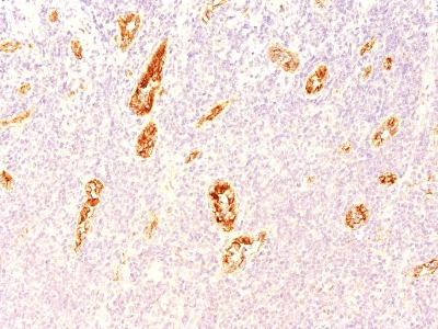 Monoclonal Antibody to von Willebrand Factor / Factor VIII Related-Ag (Endothelial Marker)(Clone : 3E2D10)