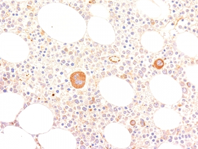 Monoclonal Antibody to von Willebrand Factor / Factor VIII Related-Ag (Endothelial Marker)(Clone : VWF635)