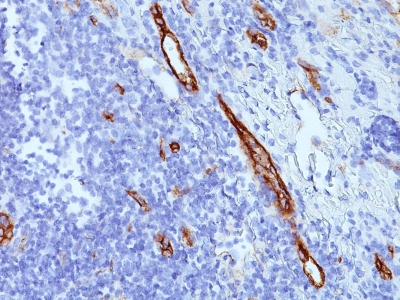 Monoclonal Antibody to von Willebrand Factor / Factor VIII Related-Ag (Endothelial Marker)(Clone : SPM577)