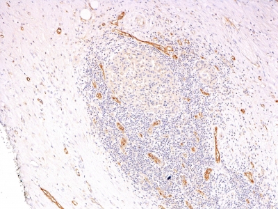 Monoclonal Antibody to von Willebrand Factor / Factor VIII Related-Ag (Endothelial Marker)(3E2D10 + VWF635)