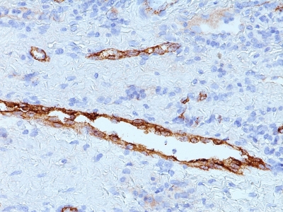 Monoclonal Antibody to von Willebrand Factor / Factor VIII Related-Ag (Endothelial Marker)(Clone : IIIE2.34)