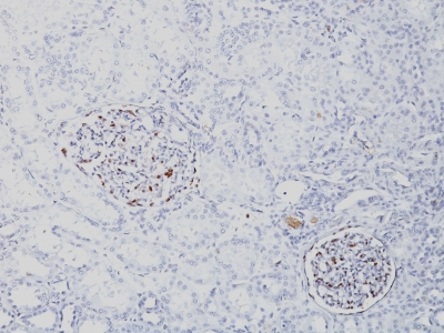 Monoclonal Antibody to Wilm's Tumor 1 (WT1) (Wilm's Tumor & Mesothelial Marker)(Clone : SPM361)