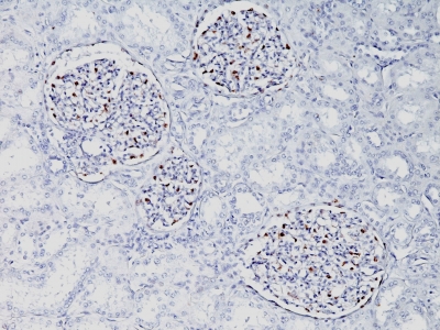 Monoclonal Antibody to Wilm's Tumor 1 (WT1) (Wilm's Tumor & Mesothelial Marker)(Clone : WT1/857)