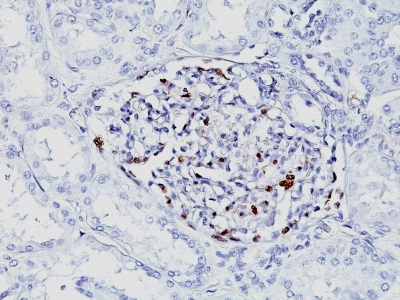 Monoclonal Antibody to Wilm's Tumor 1 (WT1) (Wilm's Tumor & Mesothelial Marker)(WT1/857 + 6F-H2)