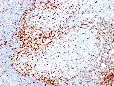 Monoclonal Antibody to ZAP70 (Chronic Lymphocytic Leukemia Marker)(Clone : 2F3.2)