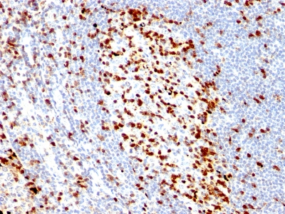 Monoclonal Antibody to ZAP70 (Chronic Lymphocytic Leukemia Marker)(Clone : ZAP70/528)