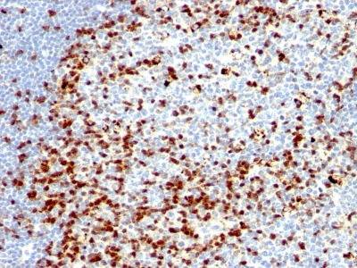 Monoclonal Antibody to ZAP70 (Chronic Lymphocytic Leukemia Marker)(ZAP70/528 + 2F3.2)