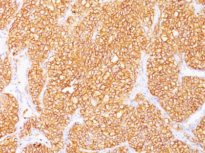 Monoclonal Antibody to Renal Cell Carcinoma / gp200(Clone : SPM314)